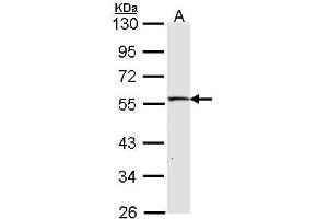 WB Image Sample (30 ug of whole cell lysate) A: IMR32 10% SDS PAGE antibody diluted at 1:1000 (STK26/MST4 抗体  (C-Term))
