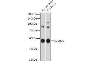 Western blot analysis of extracts of various cell lines, using C antibody (ABIN3021053, ABIN3021054, ABIN3021055 and ABIN6213930) at 1:1000 dilution. (ACVR1C/ALK7 抗体  (AA 22-113))