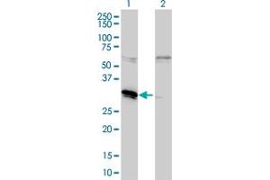 Western Blot analysis of MLF2 expression in transfected 293T cell line by MLF2 monoclonal antibody (M01), clone 2F6-1E3. (MLF2 抗体  (AA 1-248))