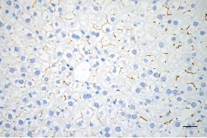 Immunohistochemistry was performed on paraffin-embedded mouse liver using ABCB1 antibody (ABIN7797683), 1:200).