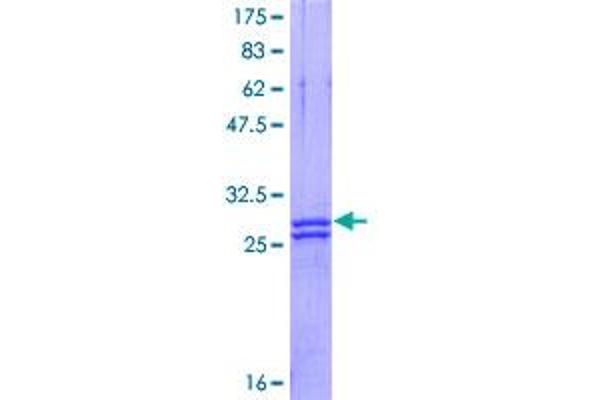 PLP1 Protein (AA 177-232) (GST tag)