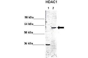 WB Suggested Anti-HDAC1 Antibody  Positive Control: Lane 1: 5ug mouse brain cytoplasm Lane 2: 5ug mouse brain nucleus  Primary Antibody Dilution :  1:1000 Secondary Antibody : Anti rabbit - IR-dye Secondry Antibody Dilution :  1:10,000  Submitted by: Anonymous (HDAC1 抗体  (C-Term))