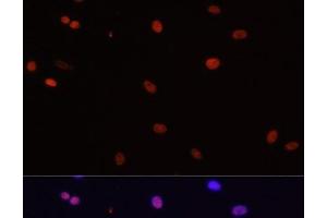 Immunofluorescence analysis of C6 cells using HDGF Polyclonal Antibody at dilution of 1:100. (HDGF 抗体)