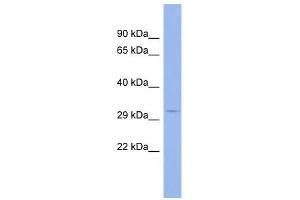 MSI2 antibody used at 1 ug/ml to detect target protein. (MSI2 抗体)