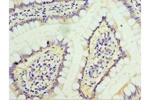Immunohistochemistry of paraffin-embedded human small intestine tissue using ABIN7156601 at dilution of 1:100 (IFNGR1 抗体  (AA 270-489))