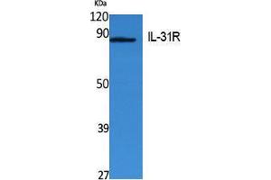 Western Blotting (WB) image for anti-Interleukin 31 Receptor A (IL31RA) (Internal Region) antibody (ABIN3180977)