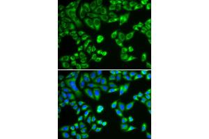 Immunofluorescence analysis of HeLa cells using SH2B1 antibody. (SH2B1 抗体)