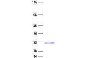 Validation with Western Blot (C17orf49 Protein (His tag))