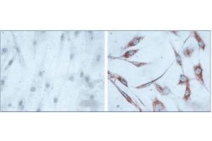 Immunohistochemistry of human skin fibroblasts (Left: control, Right: 24 hours after 7th passage of senescence). (HSPD1 抗体)