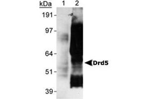 Detection of Drd5 of Sf9 cells transfected with rat Drd5 using Drd5 monoclonal antibody, clone SG4-D1b . (DRD5 抗体  (C-Term))