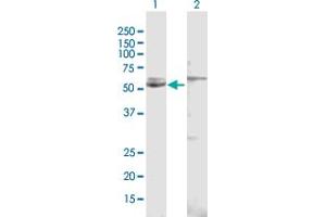 Western Blotting (WB) image for anti-Cytochrome P450, Family 51, Subfamily A, Polypeptide 1 (CYP51A1) (AA 1-509) antibody (ABIN1327035)