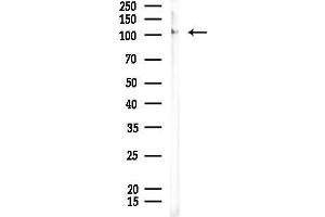 Western blot analysis of lysates from EC304 cells, using Phospho-NMDAR1 (Ser890) Antibody at 1/1000 dilution.