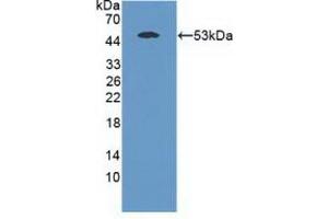 Detection of Recombinant MASP1, Mouse using Polyclonal Antibody to Mannose Associated Serine Protease 1 (MASP1) (MASP1 抗体  (AA 25-453))