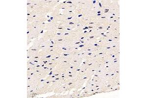 Immunohistochemistry (Paraffin-embedded Sections) (IHC (p)) image for anti-Hairy and Enhancer of Split 2 (HES2) antibody (ABIN7074158)
