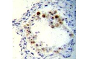 CDKN2B antibody immunohistochemistry analysis in formalin fixed and paraffin embedded human lung tissue