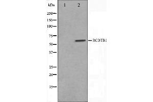Western blot analysis on LOVO cell lysate using RCBTB1 Antibody,The lane on the left is treated with the antigen-specific peptide. (RCBTB1 抗体  (Internal Region))