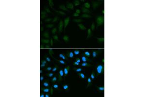 Immunofluorescence analysis of HepG2 cell using EPPIN antibody. (Eppin 抗体)