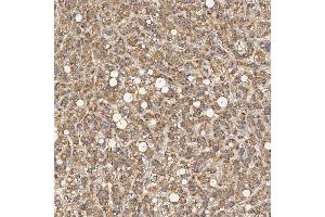 IHC analysis of SEC31A using anti-SEC31A antibody (ABIN7599630).