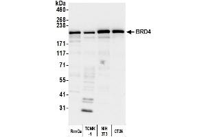 Western Blotting (WB) image for anti-Bromodomain Containing 4 (BRD4) (AA 1312-1362) antibody (ABIN7453424) (BRD4 抗体  (AA 1312-1362))