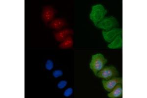 ABIN6264187 and ABIN6274036 staining Hela cells(45 min of heat-shock) by IF/ICC. (PIK3R2 抗体  (C-Term))