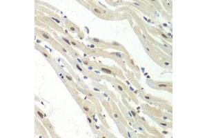 Immunohistochemistry of paraffin-embedded mouse heart using UPF1 antibody at dilution of 1:100 (x40 lens). (RENT1/UPF1 抗体)
