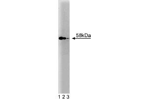 Western blot analysis of hHR23B on a A431 cell lysate (Human epithelial carcinoma, ATCC CRL-1555).