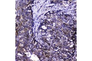 IHC analysis of Cdk6 using anti-Cdk6 antibody (ABIN5692992).