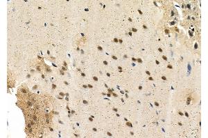 ABIN6263139 and ABIN6266820 at 1/100 staining Rat brain tissue by IHC-P. (MAST3 抗体  (Internal Region))