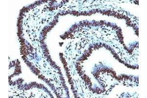 Immunohistochemistry (Formalin-fixed Paraffin-embedded Sections) (IHC (fp)) image for anti-Histone antibody (ABIN3024807)