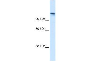WB Suggested Anti-TIP120A Antibody Titration:  1. (CAND1 抗体  (N-Term))