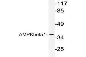 Western blot (WB) analyzes of AMPKbeta1 antibody in extracts from Jurkat cells. (PRKAB1 抗体)
