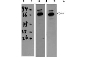 Western Blot (WB) analysis of 293T HeLa using Catalase Polyclonal Antibody diluted at 1:1000.