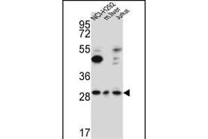 TAF1D Antibody (N-term) (ABIN651786 and ABIN2840399) western blot analysis in NCI-,Jurkat cell line and mouse liver lysates (15 μg/lane). (TAF1D 抗体  (N-Term))