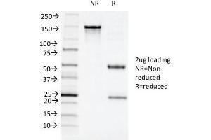 SDS-PAGE (SDS) image for anti-Integrin, alpha X (Complement Component 3 Receptor 4 Subunit) (ITGAX) (AA 637-827) antibody (ABIN6939819)