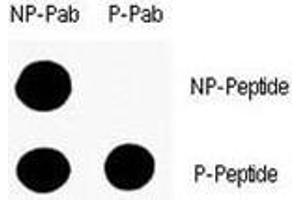 Dot Blot (DB) image for anti-Tumor Protein P53 (TP53) (pSer9) antibody (ABIN3029389)