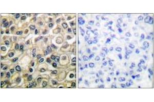 Immunohistochemistry (IHC) image for anti-Claudin 1 (CLDN1) (AA 162-211) antibody (ABIN1533224)