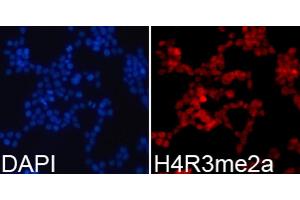 Immunofluorescence analysis of 293T cells using Asymmetric DiMethyl-Histone H4-R3 antibody (ABIN3016059, ABIN3016060, ABIN3016061, ABIN1680261 and ABIN6219537). (Histone H4 抗体  (2meArg3))