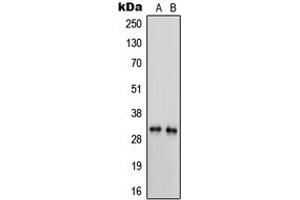 Western blot analysis of Trypsin 3 expression in MDAMB231 (A), HL60 (B) whole cell lysates. (PRSS3 抗体  (Center))