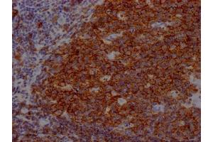 Immunohistochemistry (IHC) image for anti-CD19 Molecule (CD19) antibody (ABIN7127396)