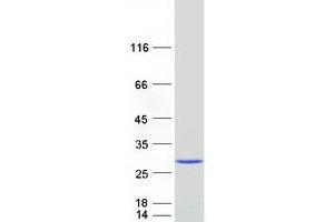 Western Blotting (WB) image for Crystallin, gamma S (CRYGS) protein (Myc-DYKDDDDK Tag) (ABIN2715241)