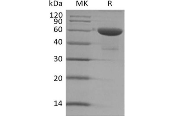 TMED1 Protein (Fc Tag)