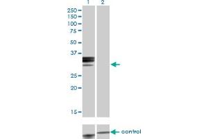 Western blot analysis of HPX over-expressed 293 cell line, cotransfected with HPX Validated Chimera RNAi (Lane 2) or non-transfected control (Lane 1). (Hemopexin 抗体  (AA 1-254))