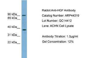 WB Suggested Anti-HGF  Antibody Titration: 0.