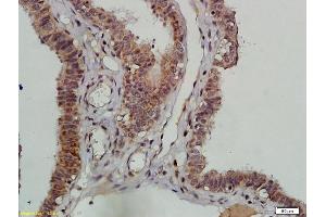 Formalin-fixed and paraffin embedded human ovarian tissue labeled with Anti-DNAPK/PRKDC Polyclonal Antibody, Unconjugated (ABIN685417) followed by conjugation to the secondary antibody and DAB staining (PRKDC 抗体  (AA 151-300))