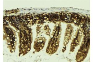 Immunohistochemistry (IHC) image for anti-POU Domain, Class 2, Transcription Factor 1 (POU2F1) (Internal Region) antibody (ABIN6264361)