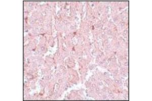 Immunohistochemistry of LXR-A in rat liver tissue with this product at 5 μg/ml. (NR1H3 抗体  (N-Term))