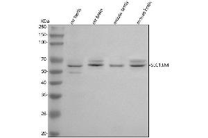 Western blot analysis of SLC13A4 using anti-SLC13A4 antibody (ABIN7599858).