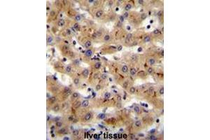 CSAD Antibody (Center) immunohistochemistry analysis in formalin fixed and paraffin embedded human liver tissue followed by peroxidase conjugation of the secondary antibody and DAB staining. (CSAD 抗体  (Middle Region))