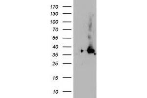 Western Blotting (WB) image for anti-Nudix (Nucleoside Diphosphate Linked Moiety X)-Type Motif 18 (NUDT18) antibody (ABIN1499859) (NUDT18 抗体)