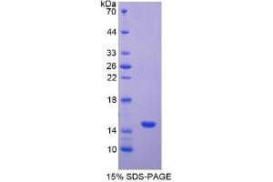 SDS-PAGE (SDS) image for Glial Fibrillary Acidic Protein (GFAP) ELISA Kit (ABIN6574131)